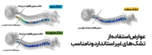عوارض استفاده از تشک غیراستاندارد